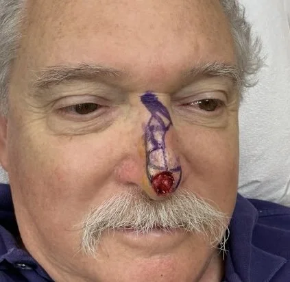 Close-up of an older man with a painted nose and a heart symbol on his nose.