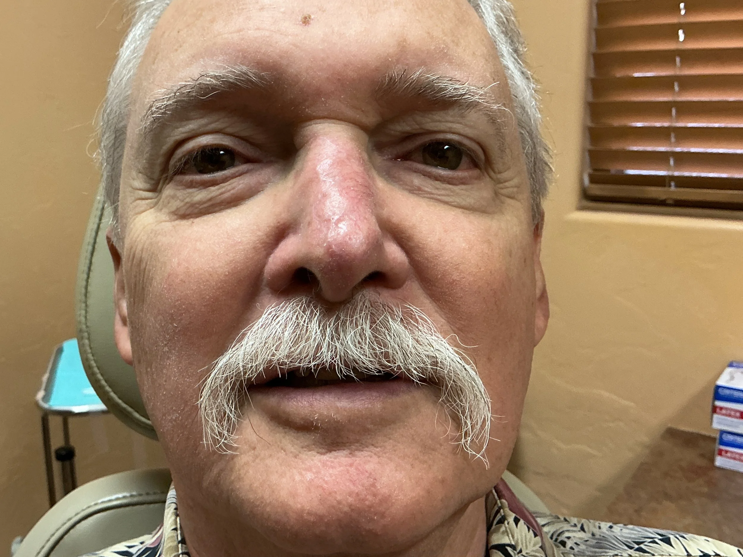 Close-up of an elderly man's face with grey hair and a white mustache, sitting in a room with wooden blinds and a medical chair.