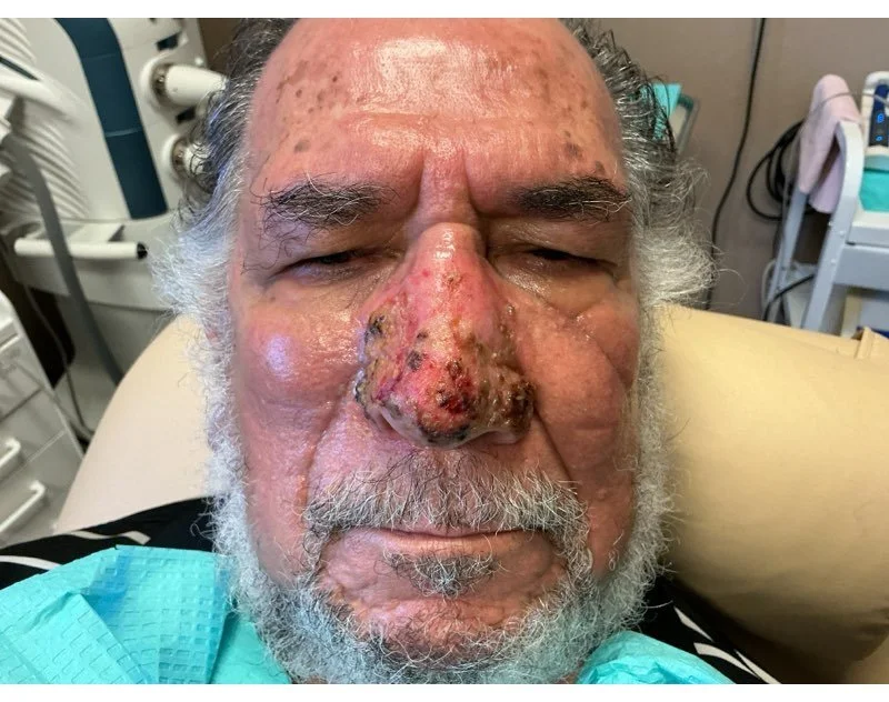 Close-up of elderly man's face with facial injuries and swelling, lying in a medical setting.