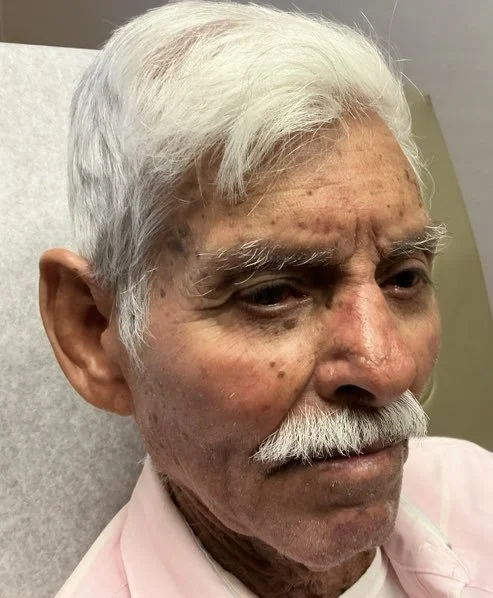 Close-up of an elderly man with white hair, a mustache, and a light pink shirt, sitting in a medical setting.