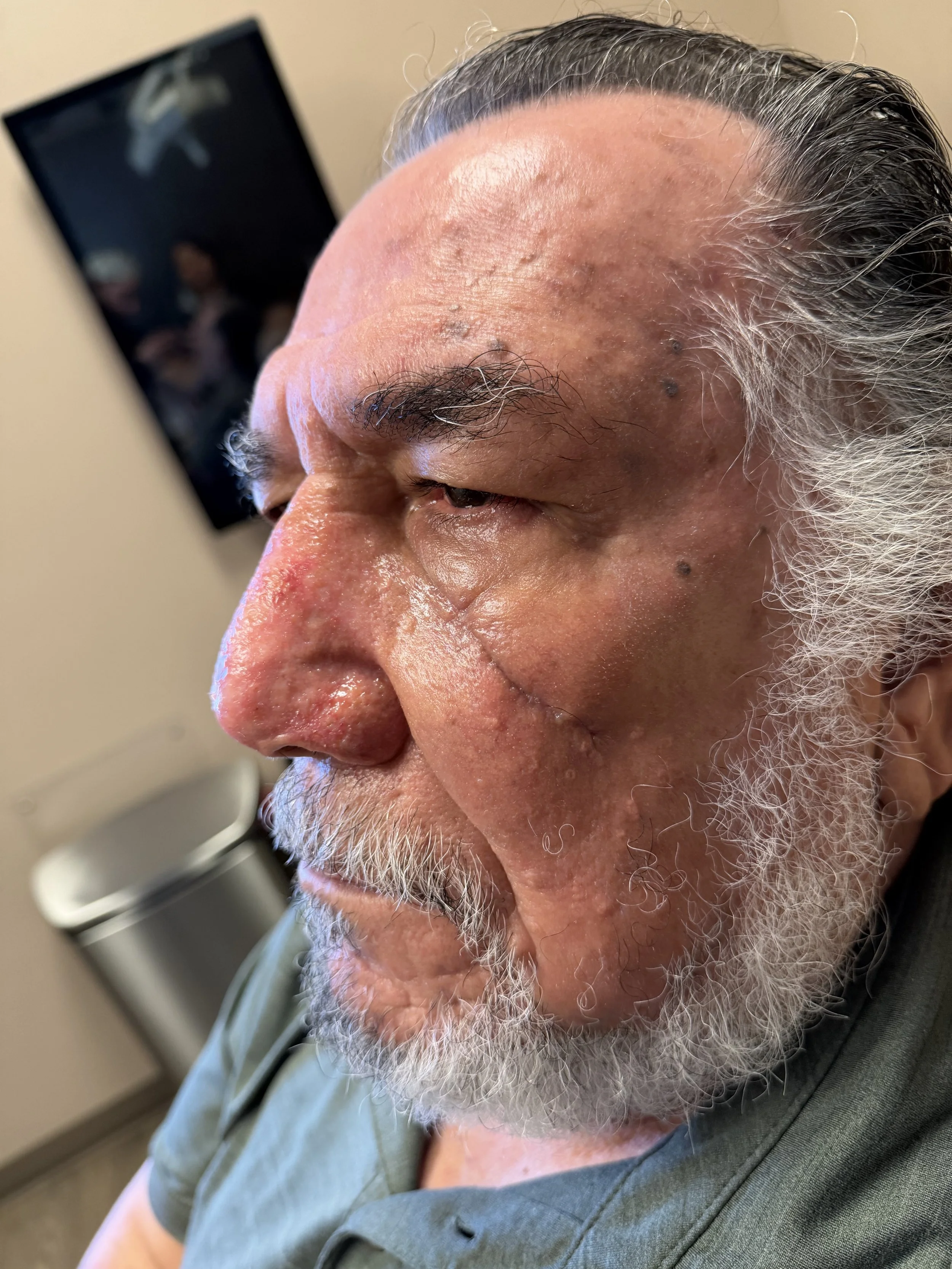 Close-up of an elderly man with gray hair and beard, wearing a green shirt. He appears to be yawning or shouting, with a bathroom or medical setting in the background.
