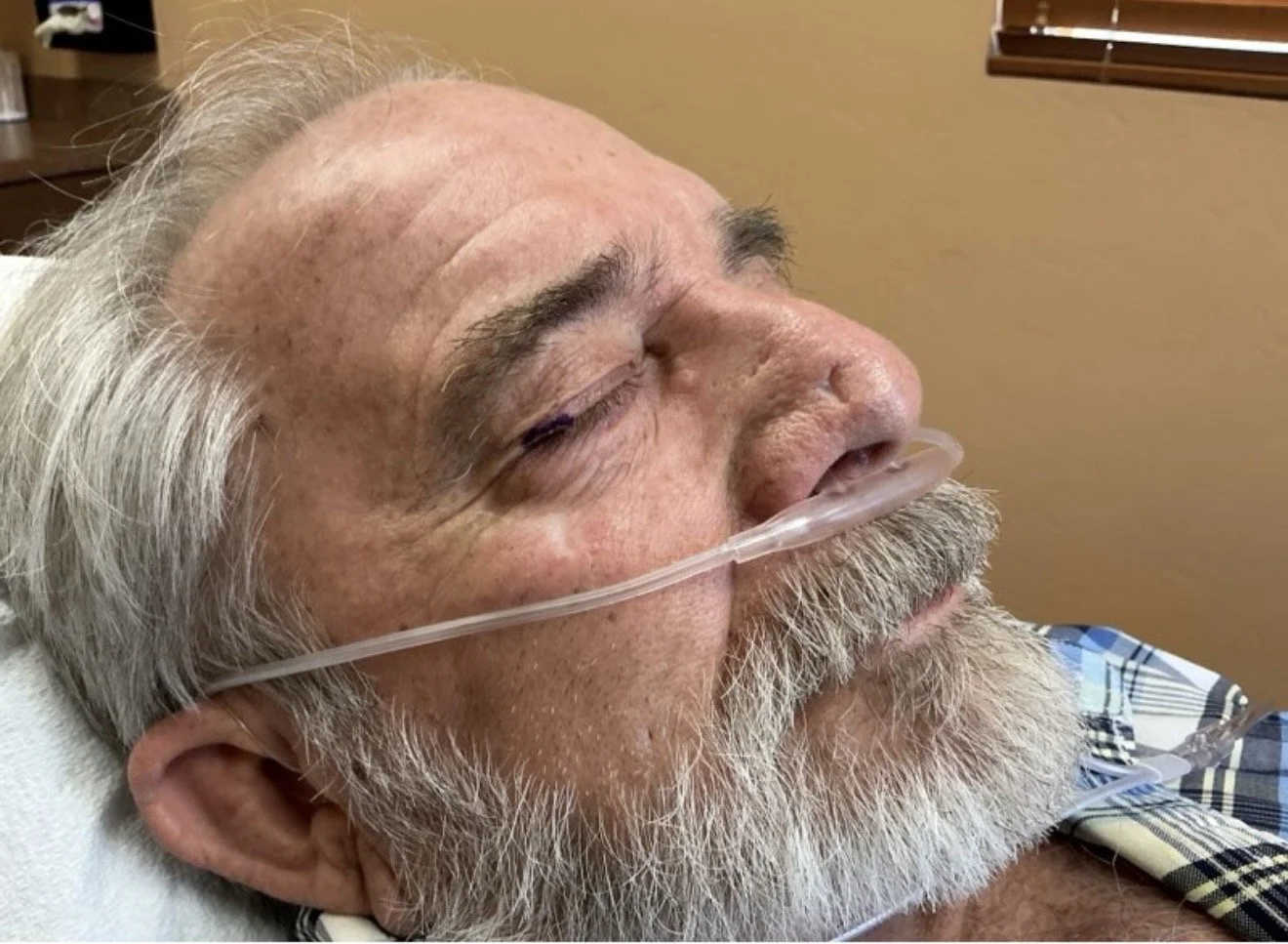 An elderly man with gray hair and beard lying in a hospital bed with a nasal oxygen tube, wearing a plaid shirt.