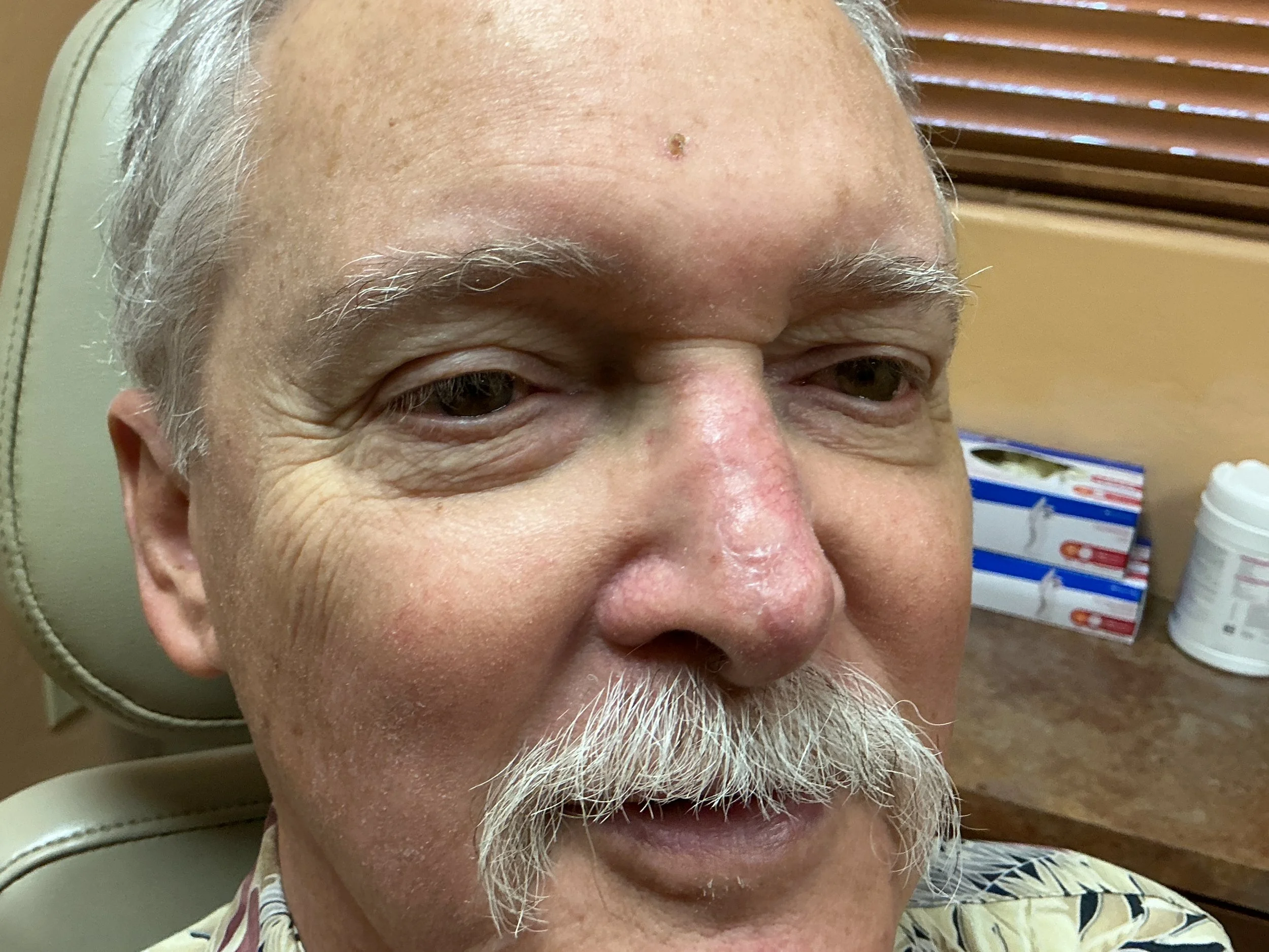 Close-up of a man with gray hair and beard, smiling and looking slightly to the side. He appears to be in a medical or dental office, with a box of medical supplies and a cardboard box visible in the background.