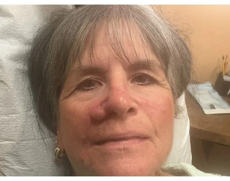 Close-up of an elderly woman's face, lying in bed with visible facial scars.