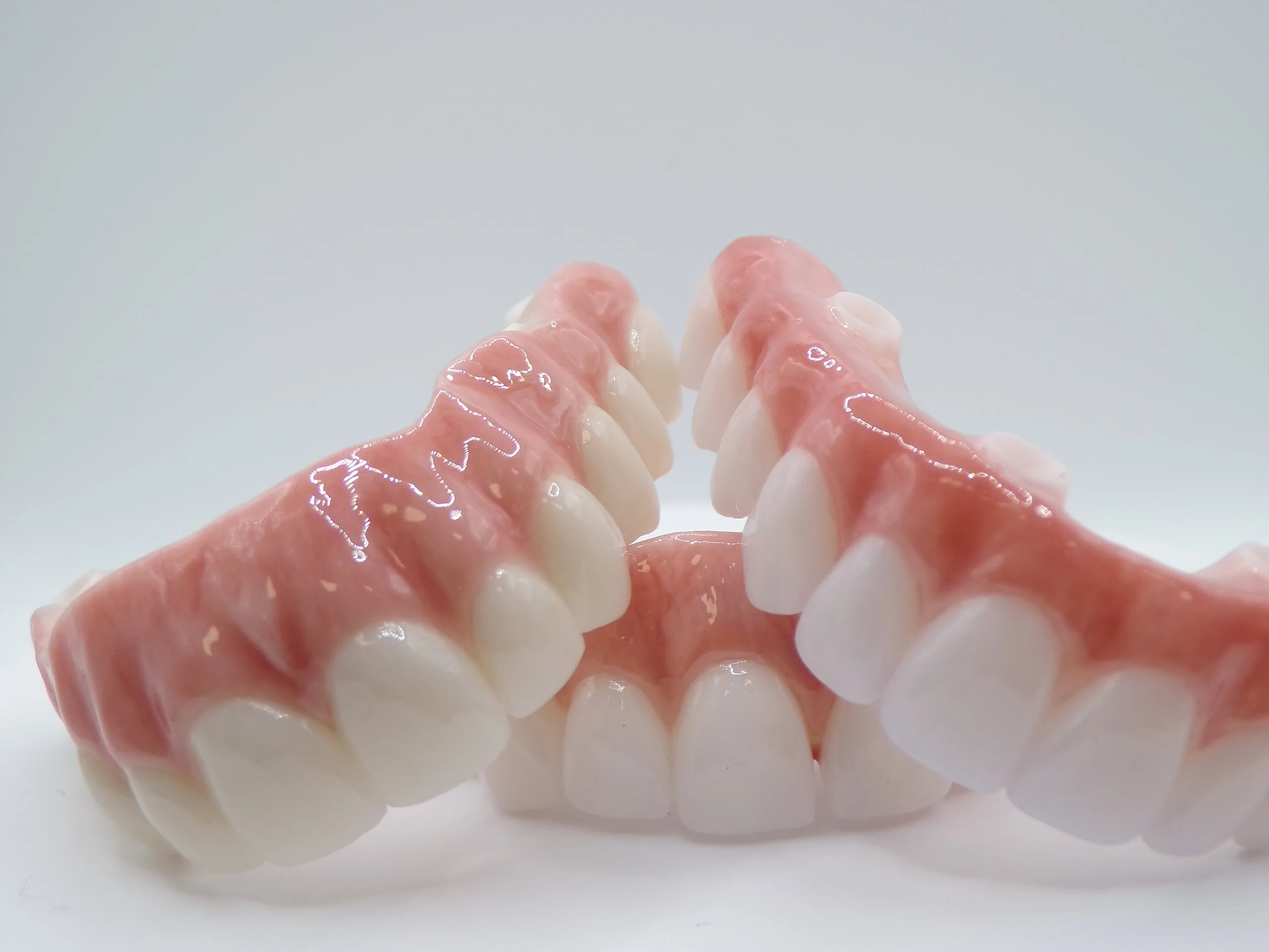 AOX zirconia bridge