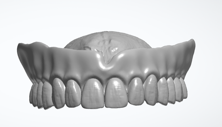 Dentures and partials