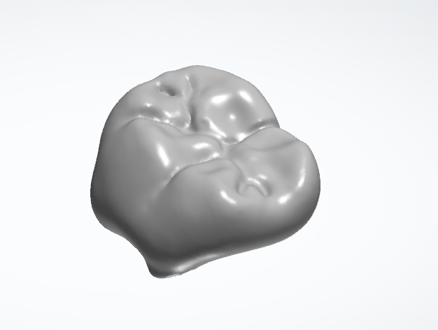 Full contour / Implant Crowns and Bridges
