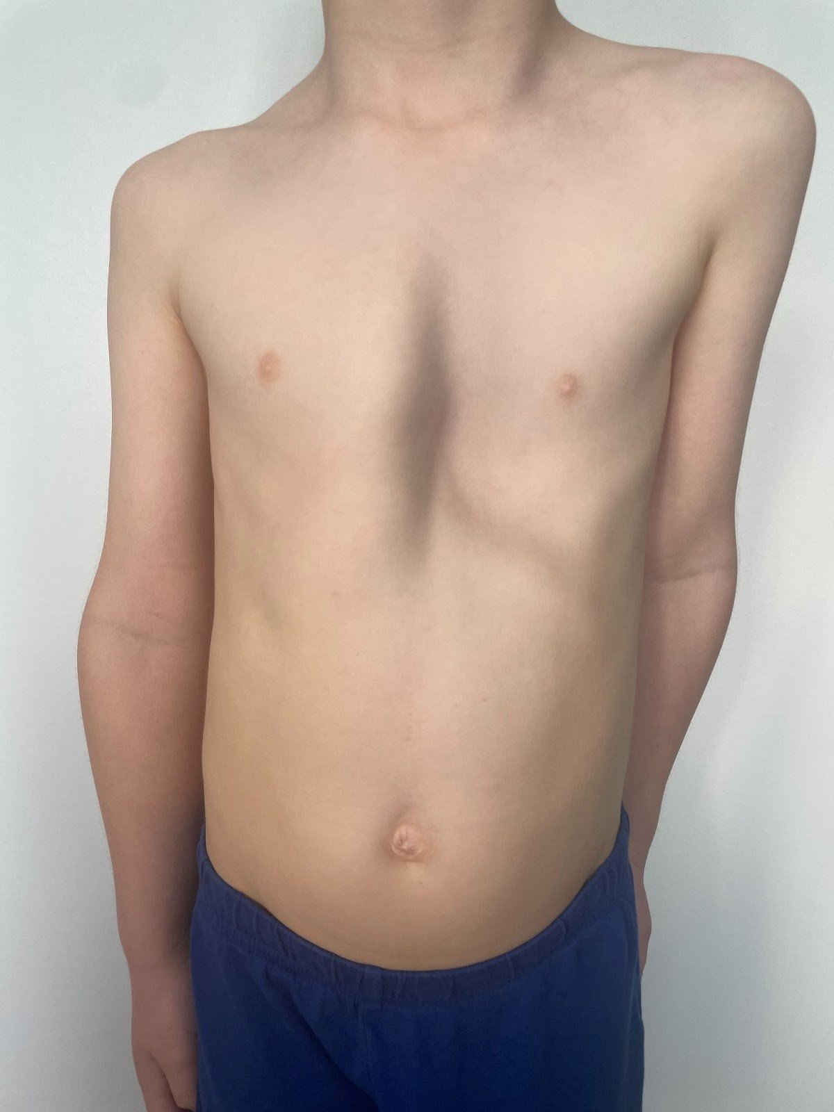 A shirtless person standing against a plain light-colored wall, wearing blue pants, with hands at the sides, showing the chest and abdomen.