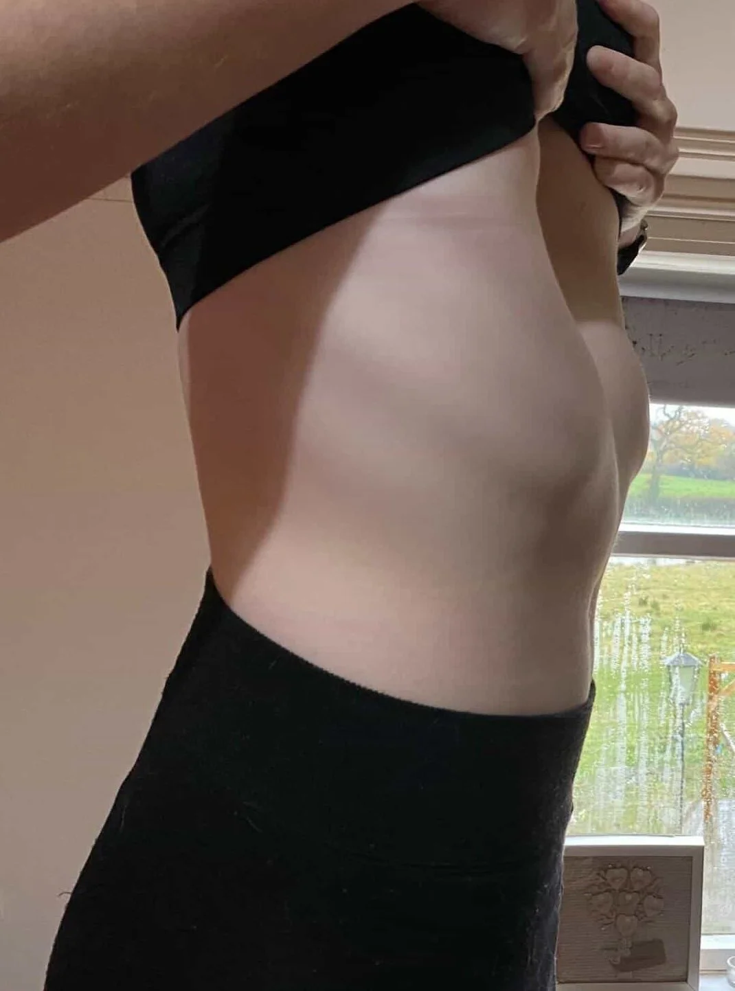 Side view of a person's torso, partially lifted shirt revealing the belly and waist, in a room with a window showing greenery outside.