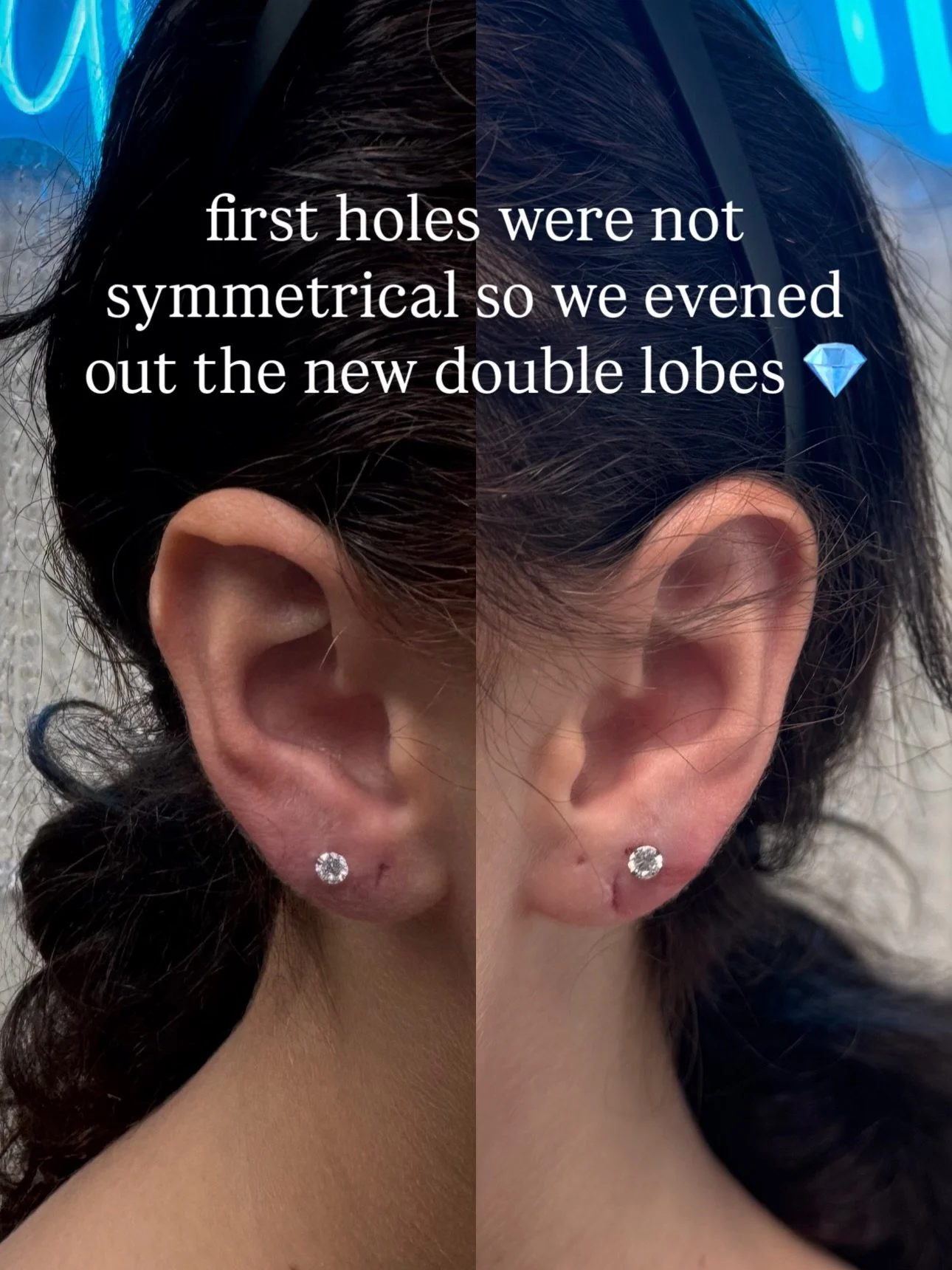 Life lately @ the studio 🤌🏼💎 Yes, we can fix messed up spacing / previous piercings! 🙂&zwj;↕️

#piercing #piercingstudio #madisonpiercing #waunakee #earpiercings