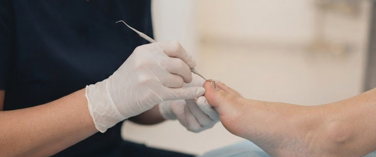 Profissional de saúde realizando uma cirurgia no dedo de uma pessoa, com uso de luvas descartáveis.