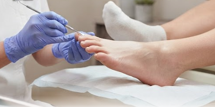Profissional fazendo uma injeção na unha do pé de uma pessoa, com uso de luvas azuis
