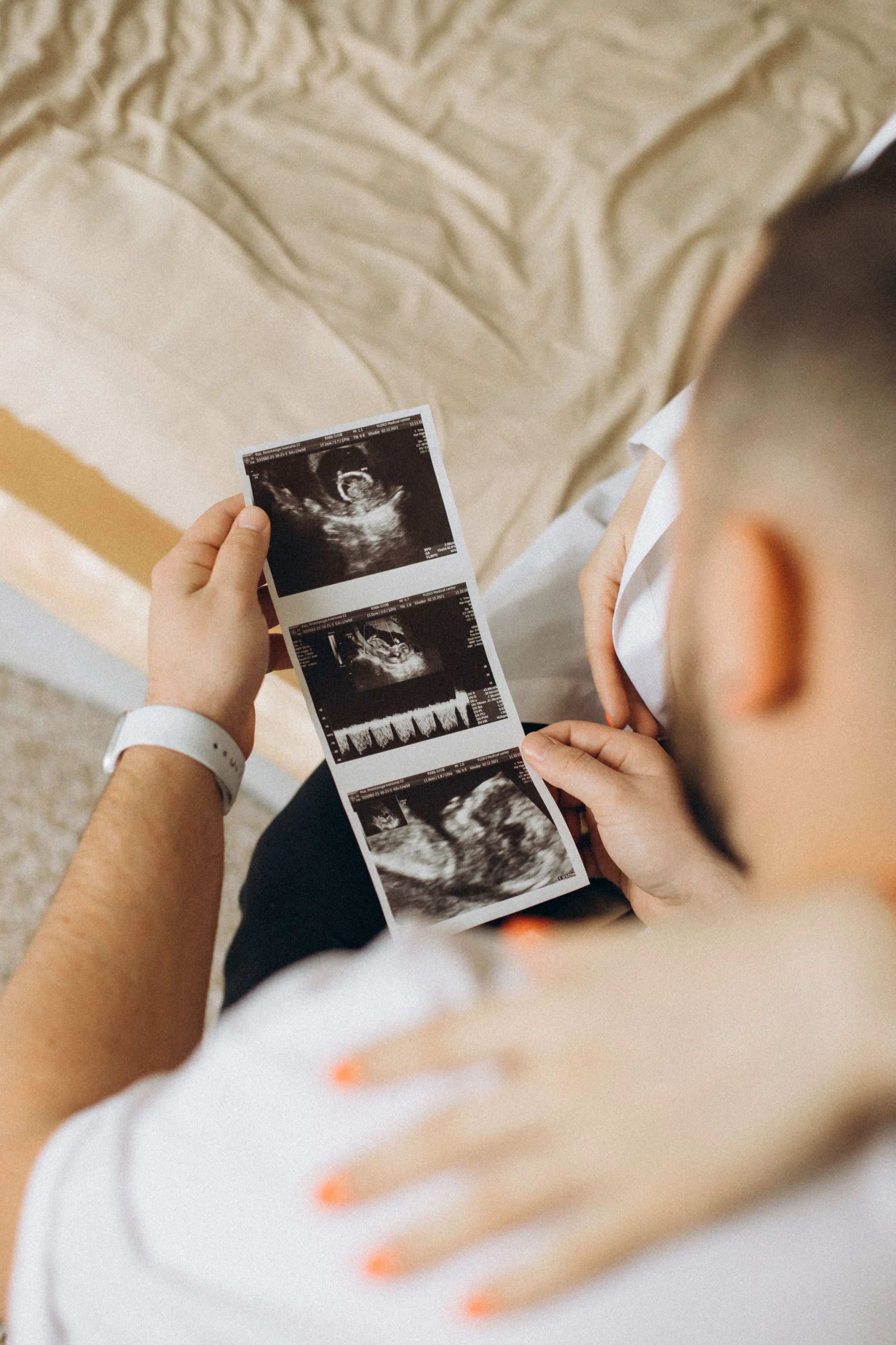 A person holding ultrasound images of a fetus, looking at them. The person is wearing a white wristband and a white shirt with orange accents. The background shows a beige bed or mattress.