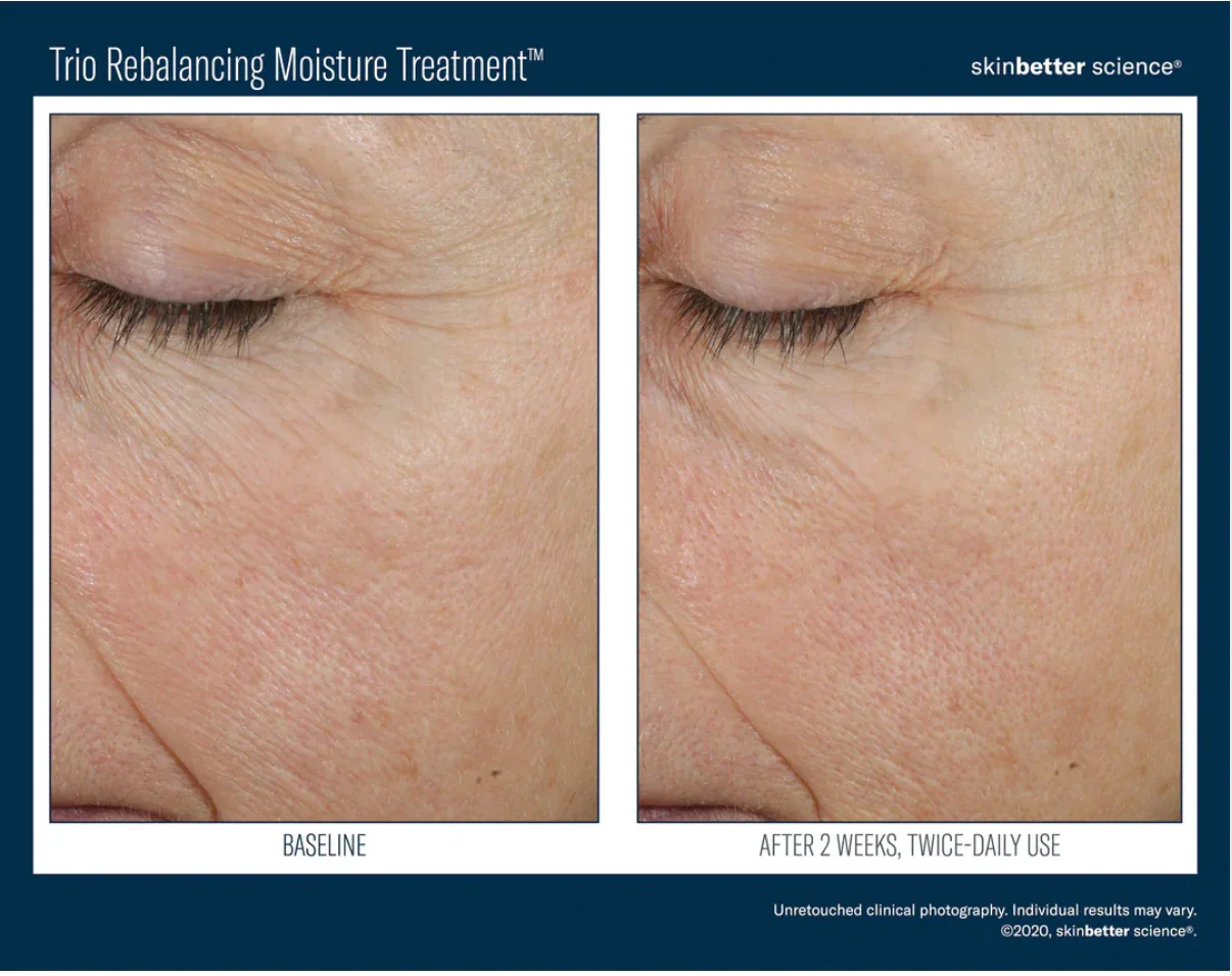 Skinbetter-Trio-4.webp