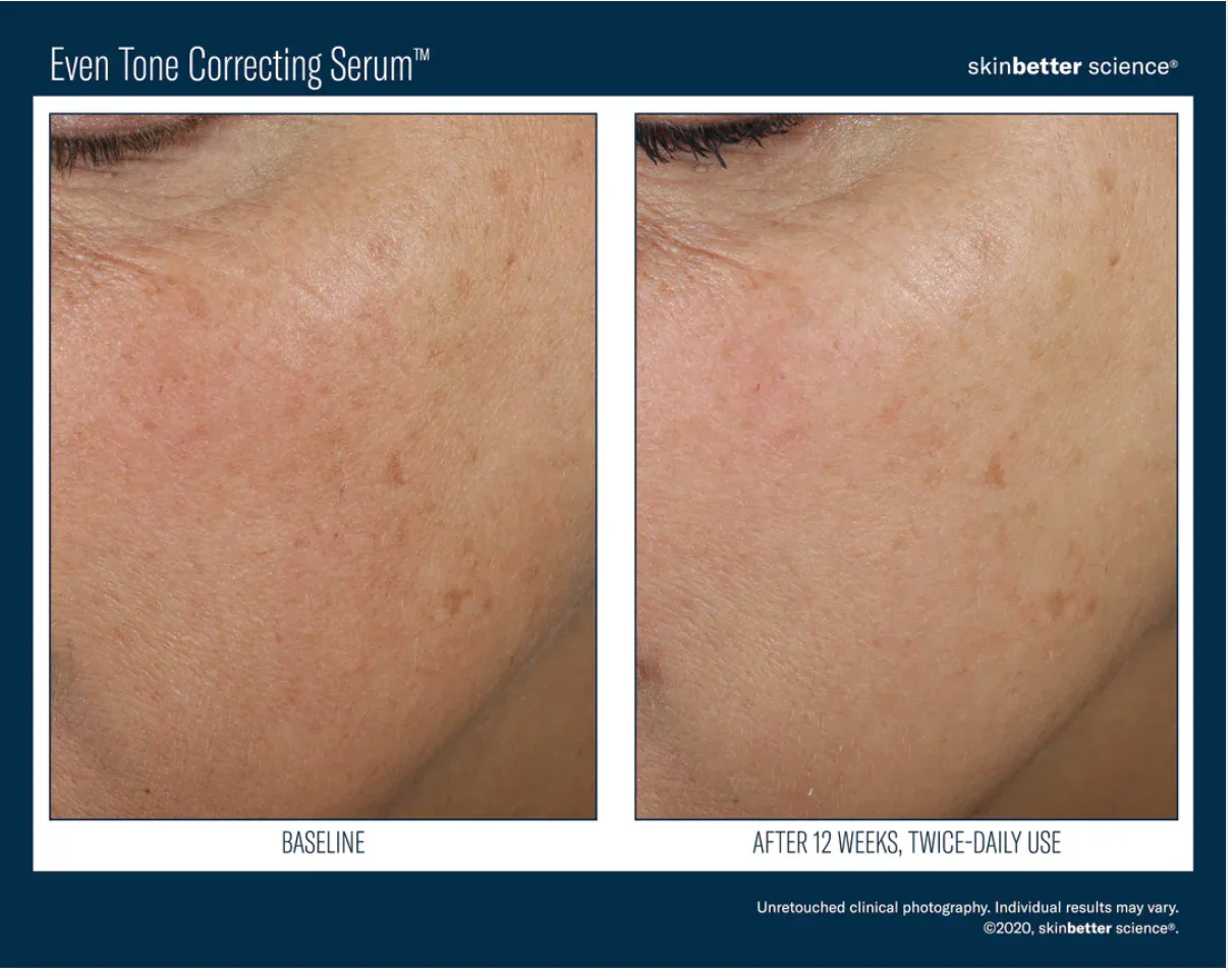 Skinbetter-Even Tone Serum-3.webp