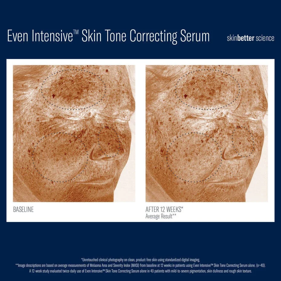 Skinbetter-CorrectingSerum-4.webp