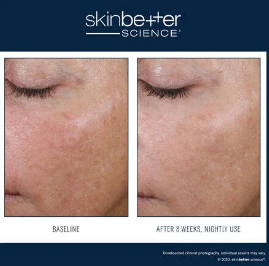 Skinbetter-AlphaRet-2.webp