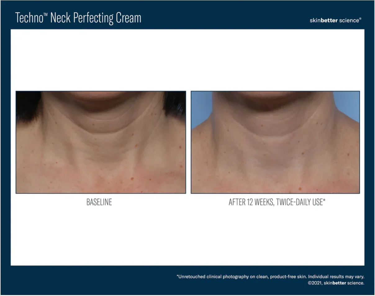 Skinbetter-Techno Neck-3.webp