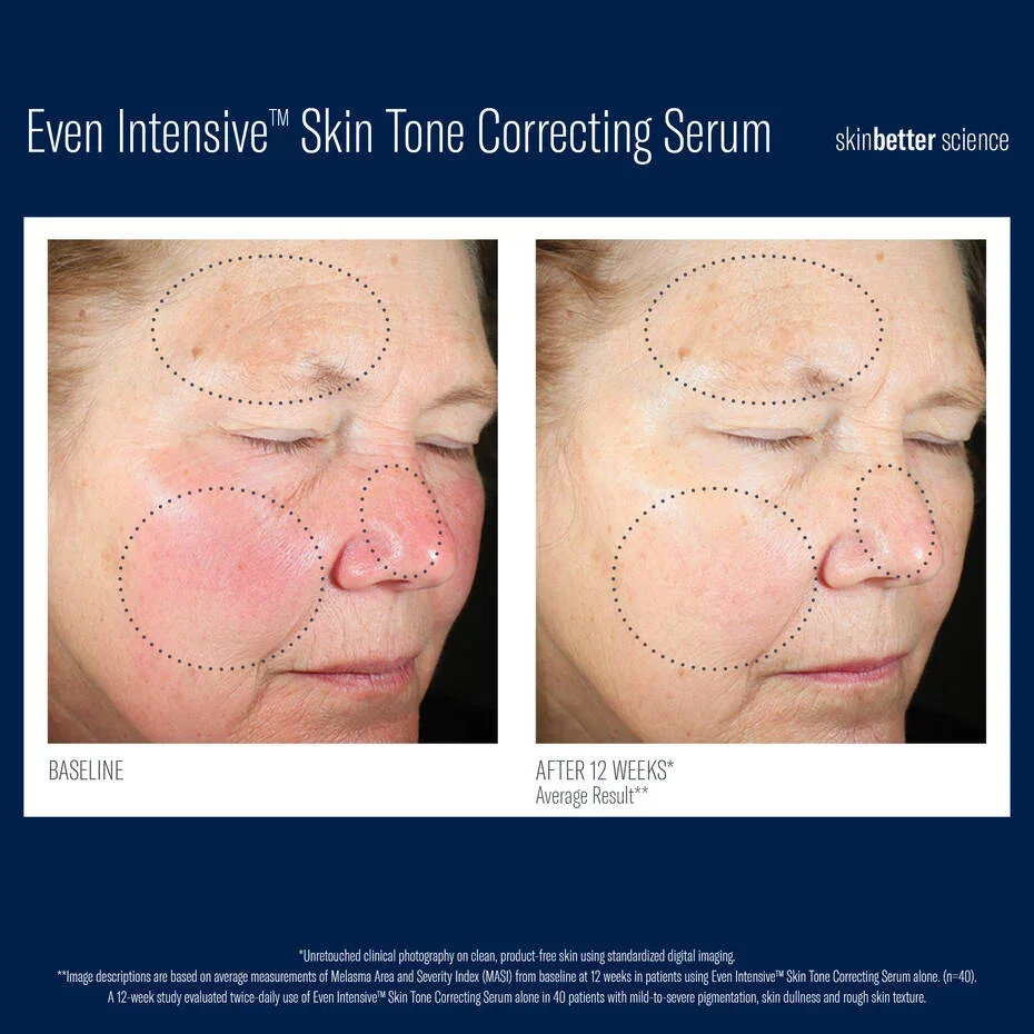 Skinbetter-CorrectingSerum-3.webp