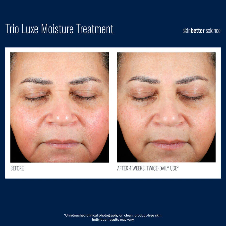 Skinbetter-Trioluxe-2.webp