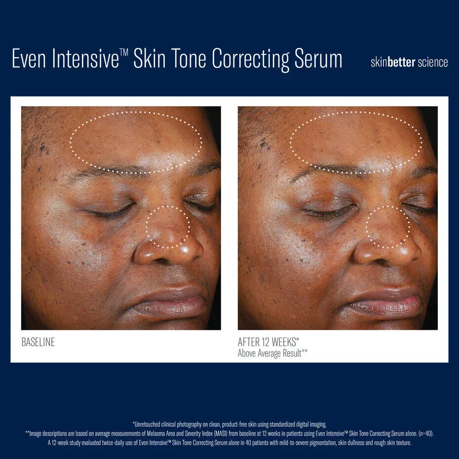Skinbetter-CorrectingSerum-2.webp