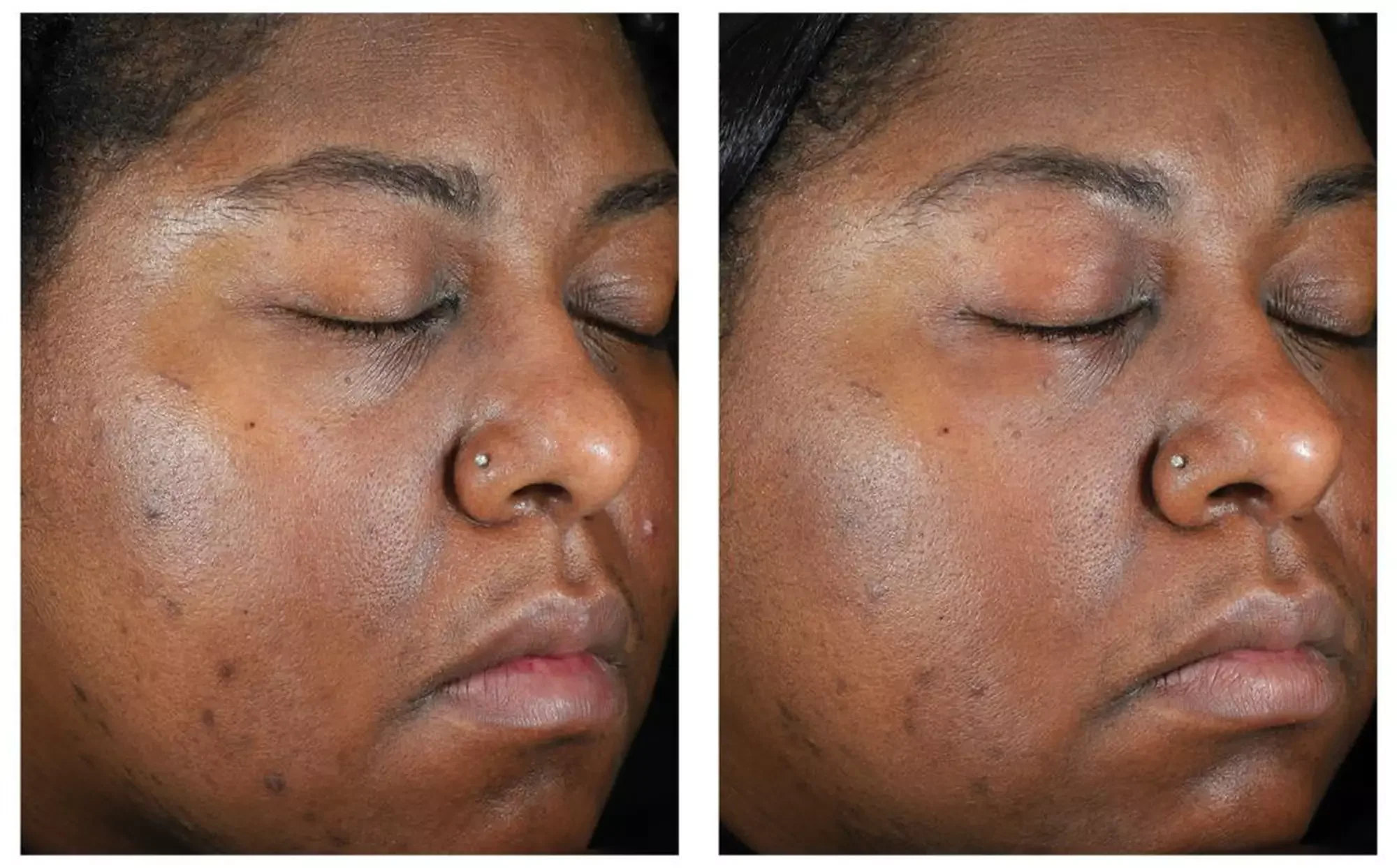 PDP_Even Intensive_Before & After_Desktop_5.webp