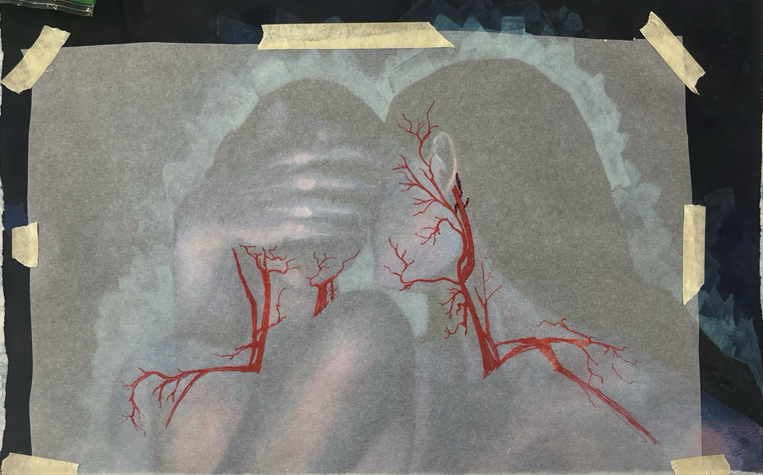An illustration of blood vessels in red on a gray atmospheric background, displayed on a piece of paper taped to a surface.