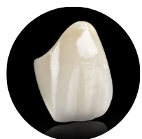IPS e.max® Crowns