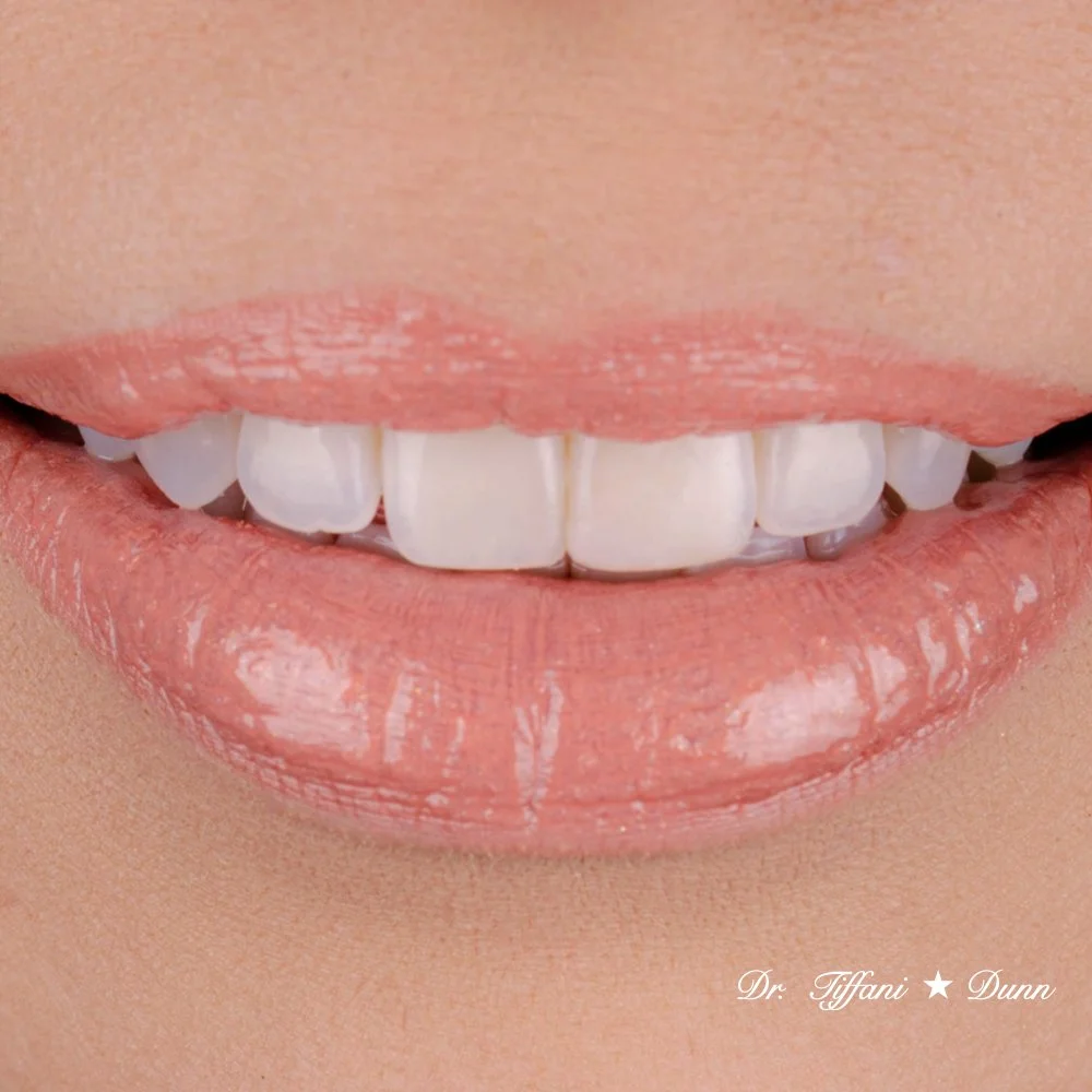 Close-up of smiling lips and teeth with glossy lipstick, showing white, straight teeth.