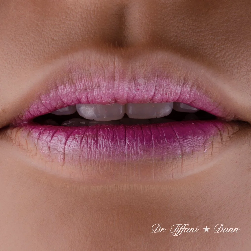Close-up of lips with pink, purple, and white lipstick, slightly parted showing front teeth, with the name "Dr. Tiffany Dunn" in the bottom right corner.
