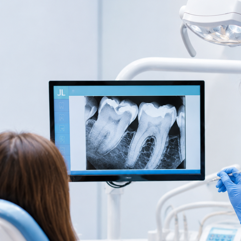 Dental Radiographs