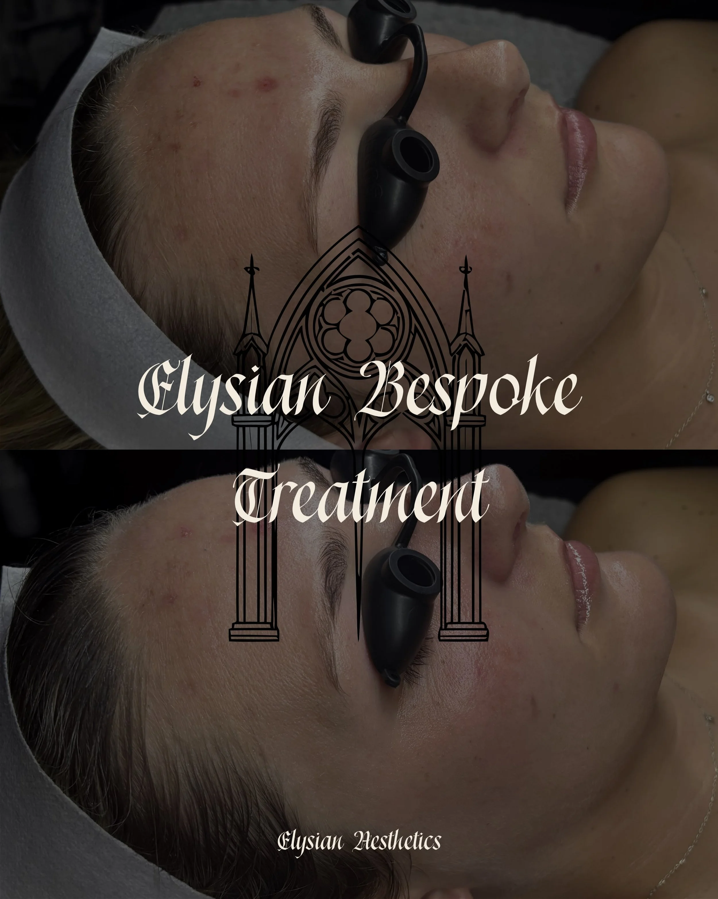 60 Uninterrupted minutes of barrier support, inflammation reduction &amp; pure relaxation🥀

The Elysian Bespoke Treatment is calling your name&hellip;🕯️