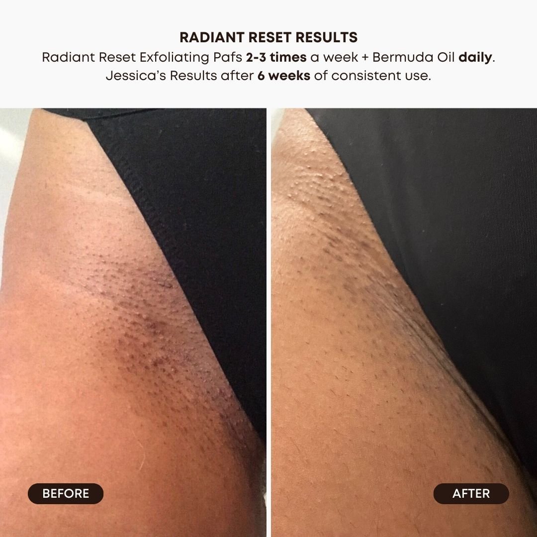 RadiantResetResults_1445x.jpg