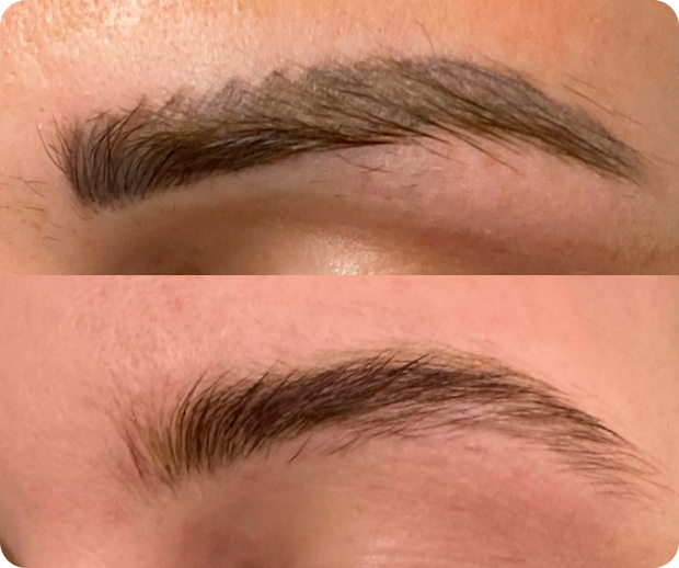 Close-up of two eyebrows, one above the other, showing differences in hair density and shape.