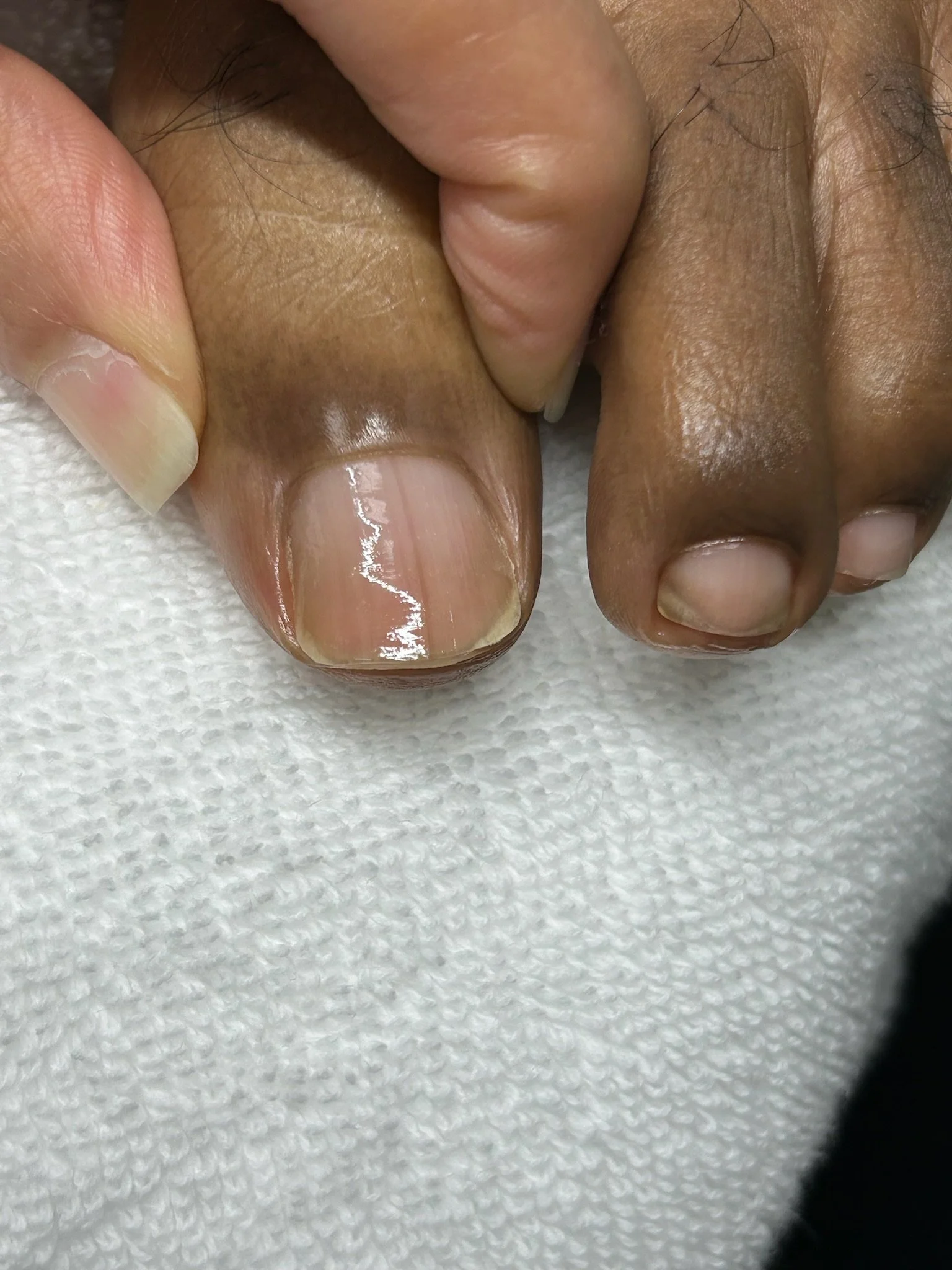 Close-up of fingernails on fingers gripping a textured white surface.