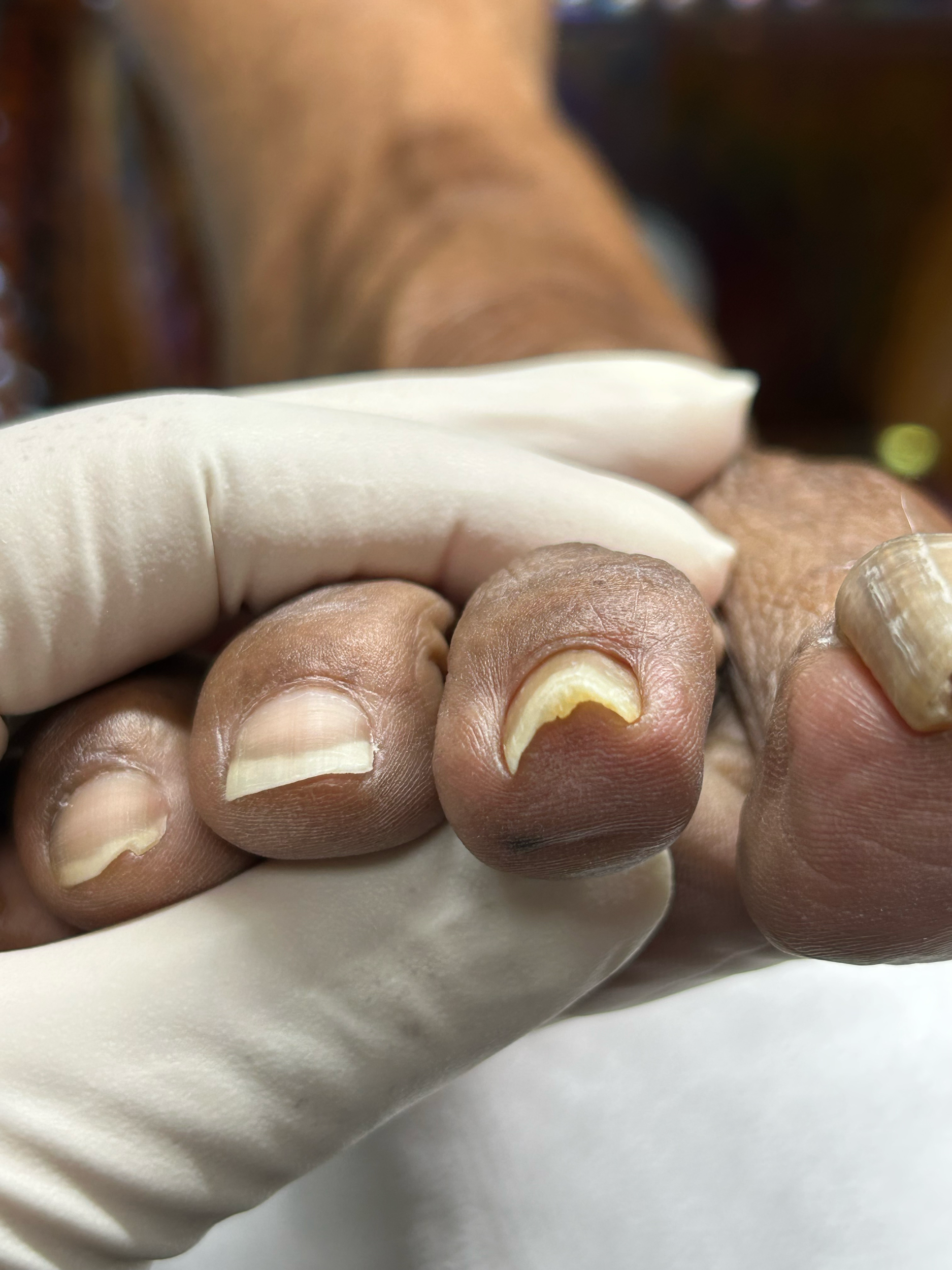 Close-up of a person's hand holding a small white object with a smooth surface, while wearing a glove. The background is blurred.