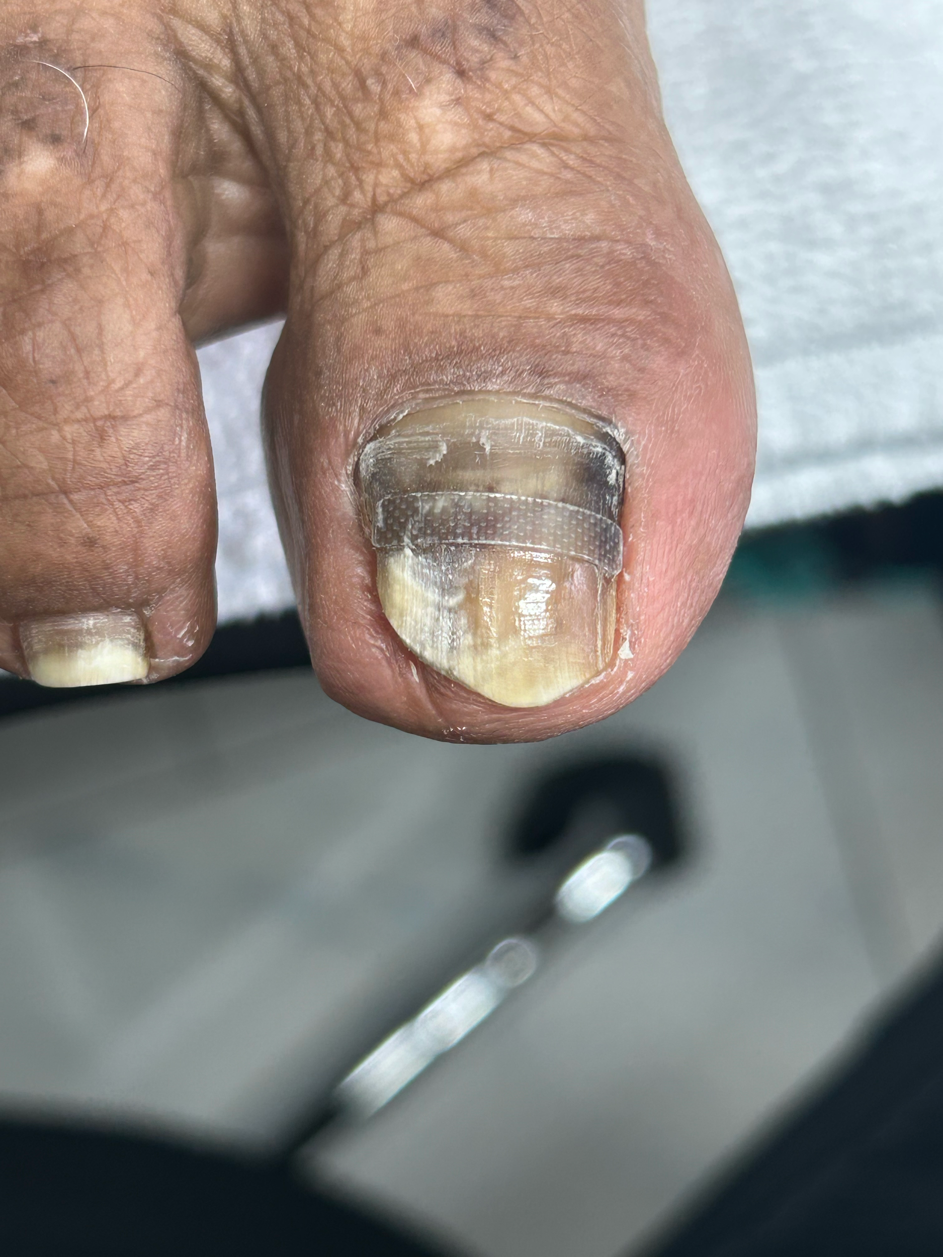 Close-up of a person's finger with a bandage or realistic medical strip on the fingernail, with a blurred metallic surface background.