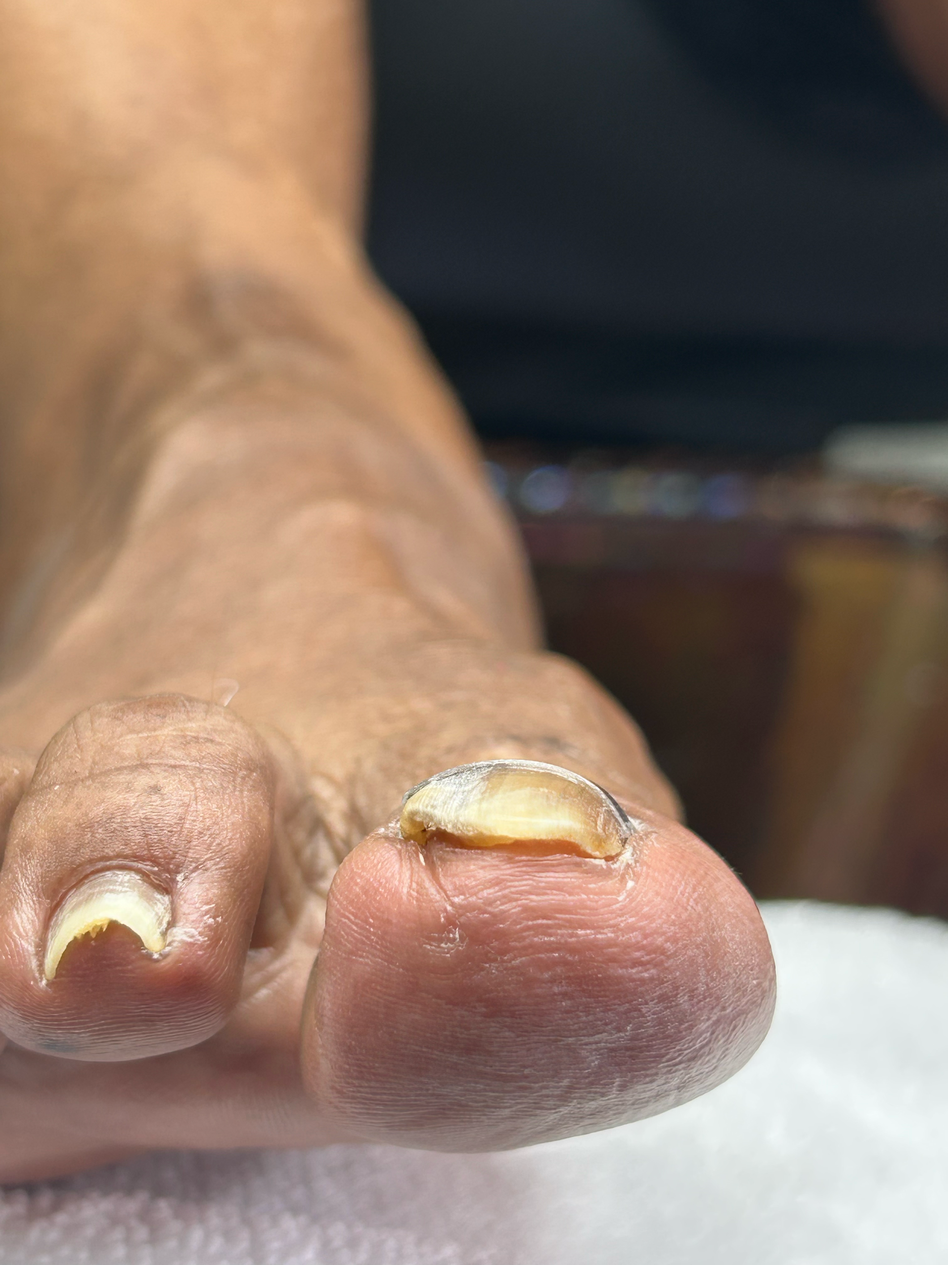 Close-up of a person's hand with slightly dirty nails, holding a peeled garlic clove. The background is out of focus.