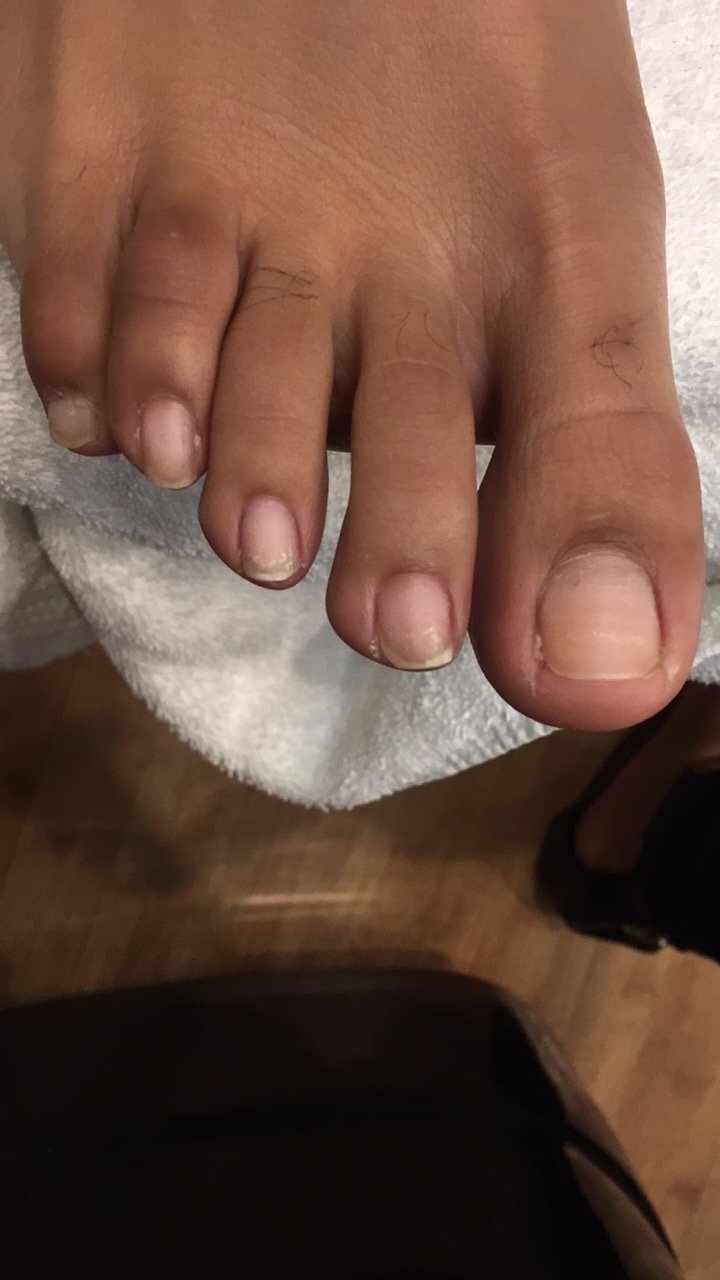 Close-up of a person's hand and fingers, showing nails and skin details.