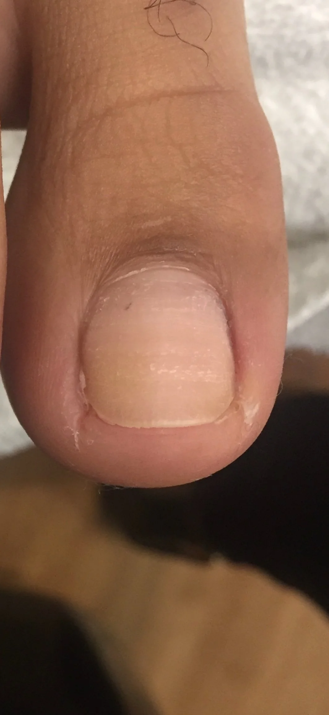 Close-up of a human thumb.