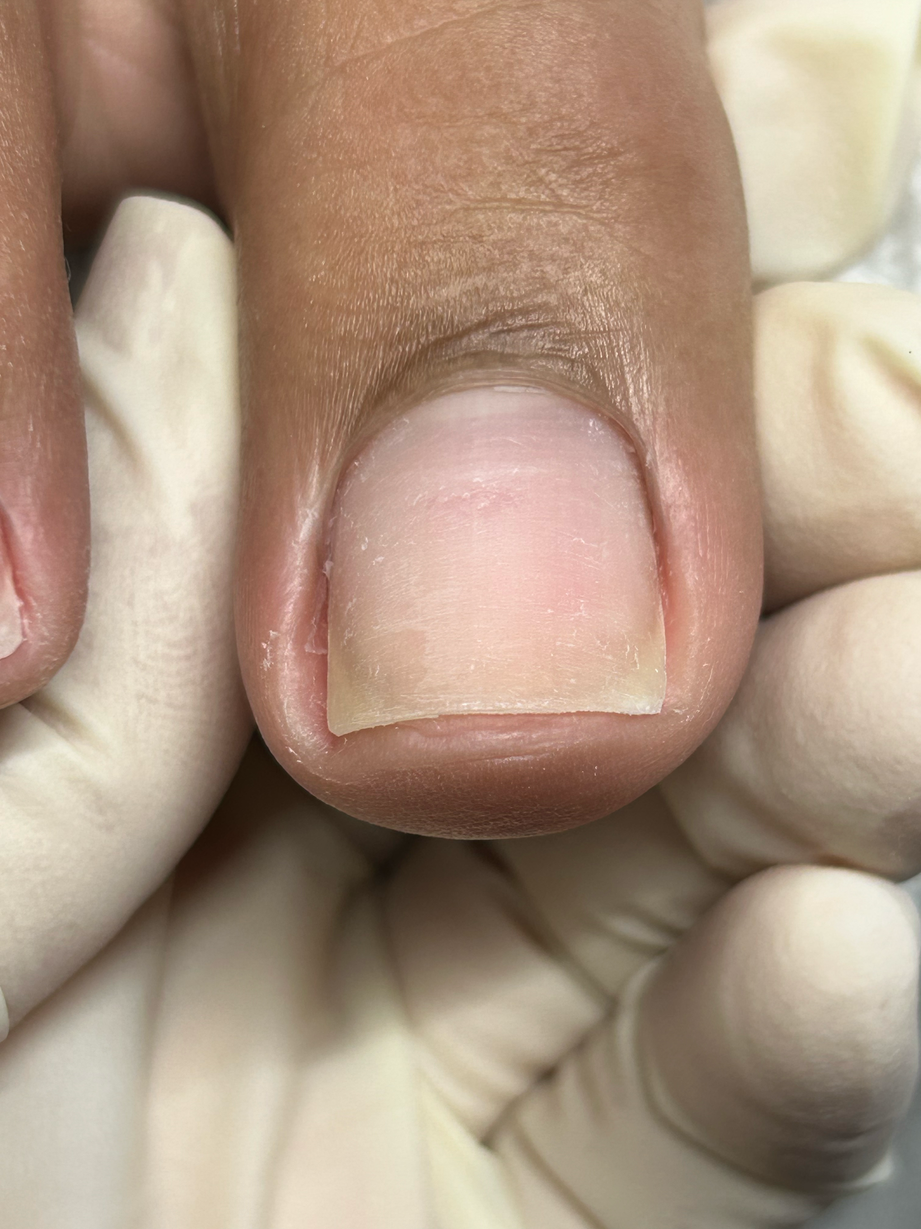 Close-up of a person's thumb with a well-manicured nude-colored nail, surrounded by other nails being held or manipulated.