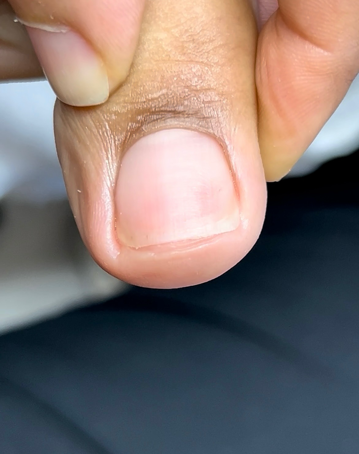 Close-up of a person's thumb and index finger holding the tip of the index finger.