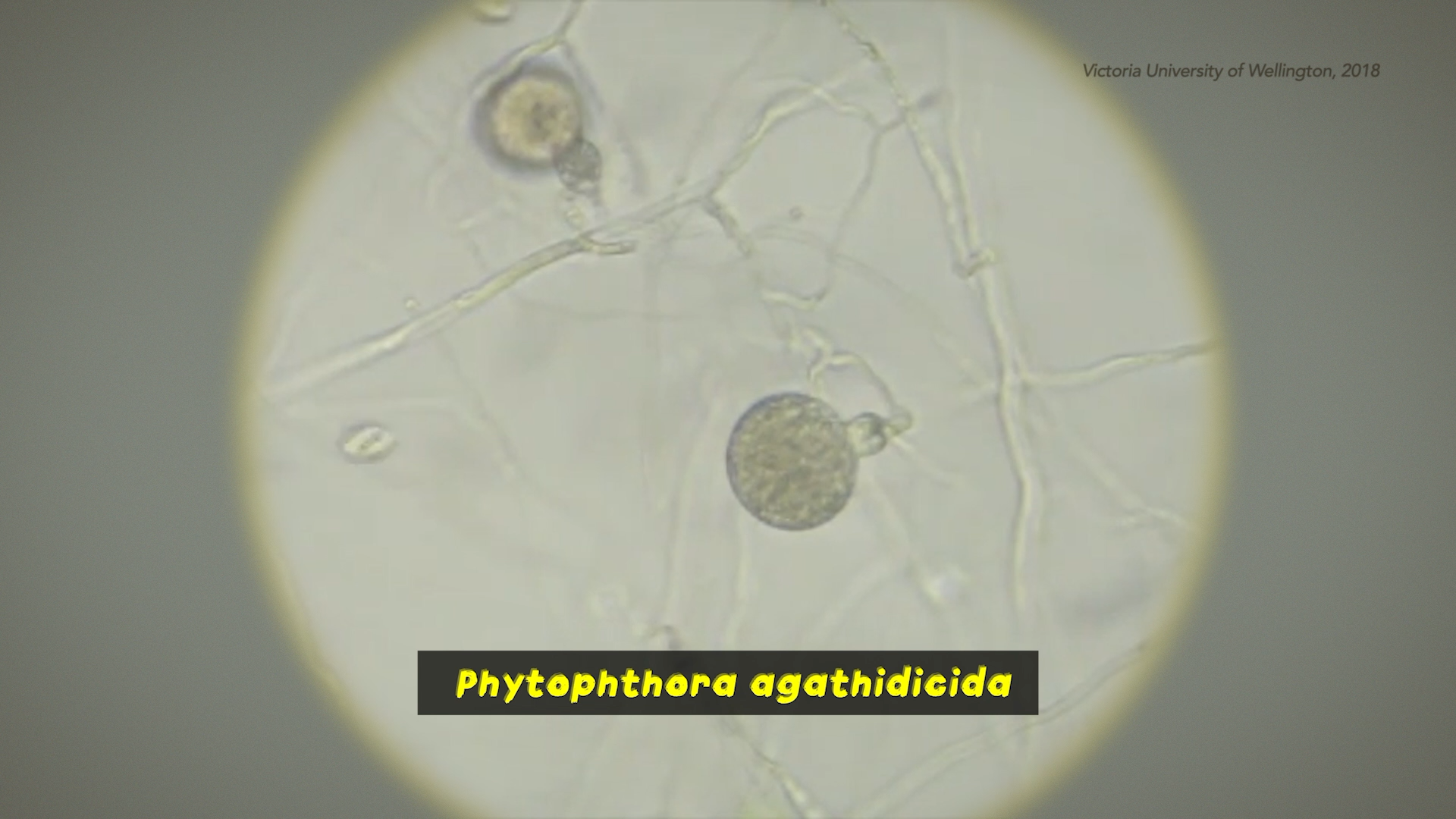 Phytophthora agathidicida under microscope, courtesy of Victoria University of Wellington