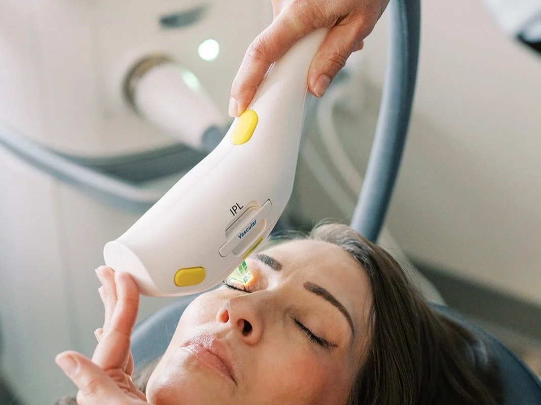 A woman receiving a laser eye treatment in a clinical setting.