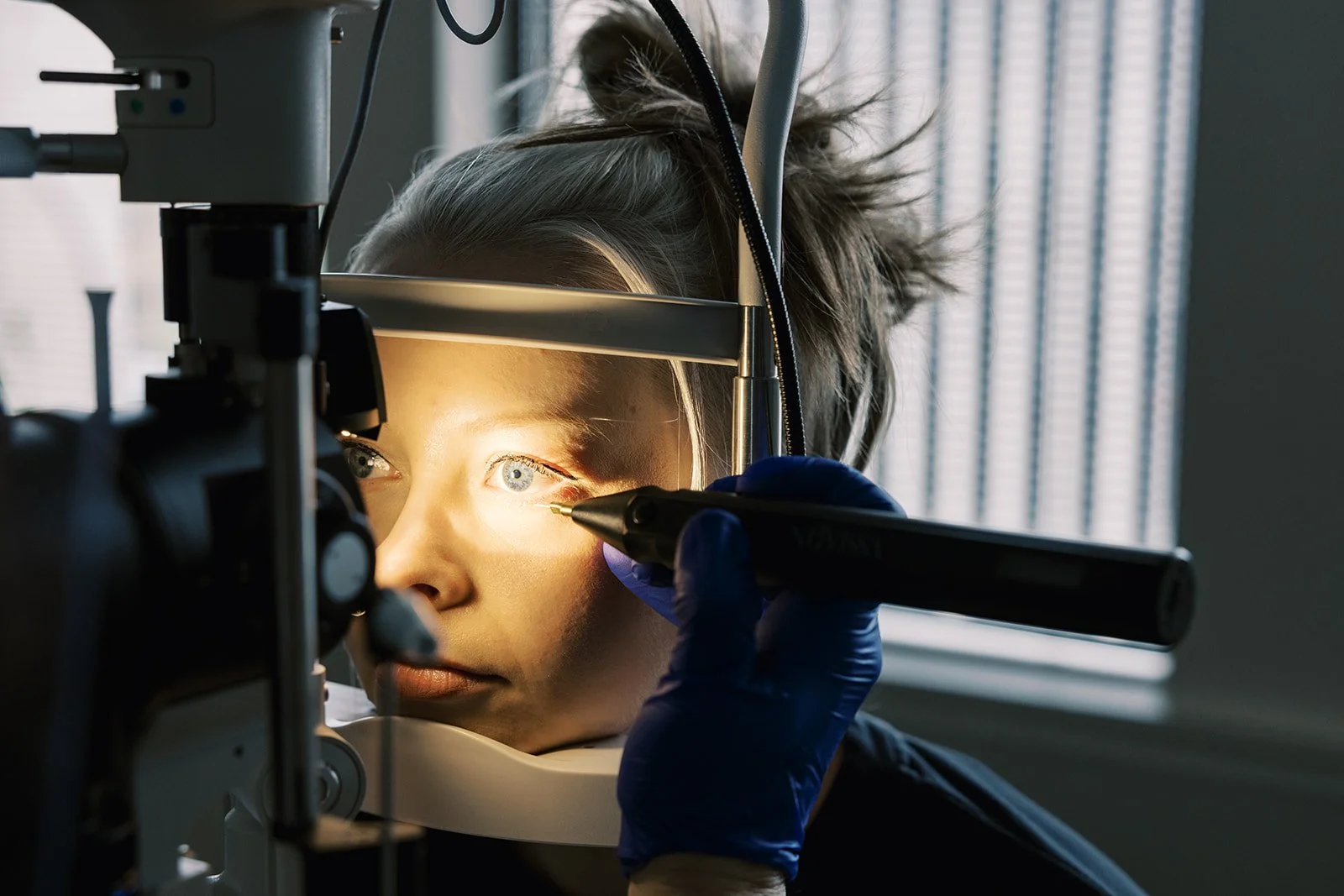 Nuvissa Plasma pen conjunctivochalasis repair (Cch)