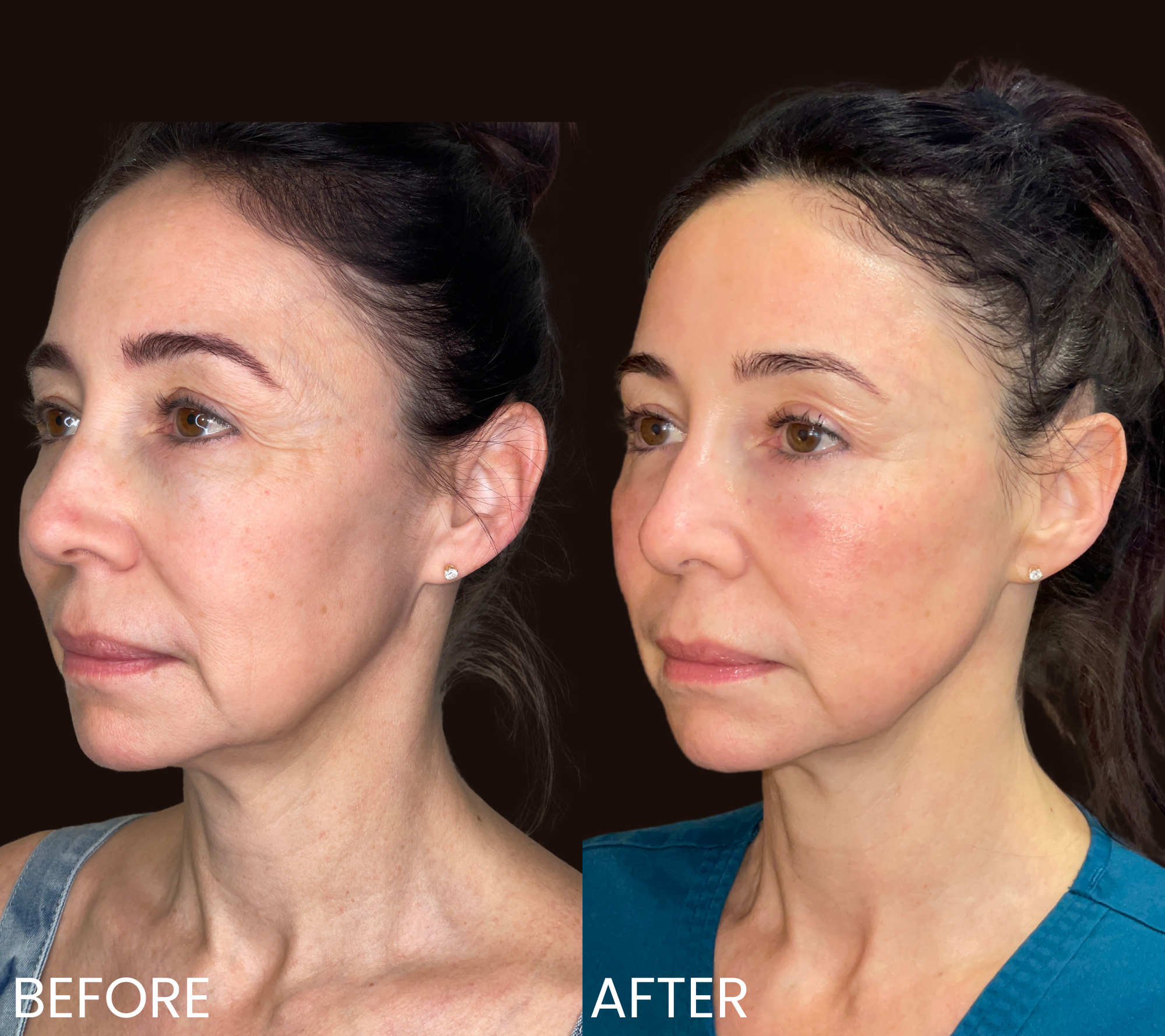 Customized Skincare + Resurfacing Treatment 