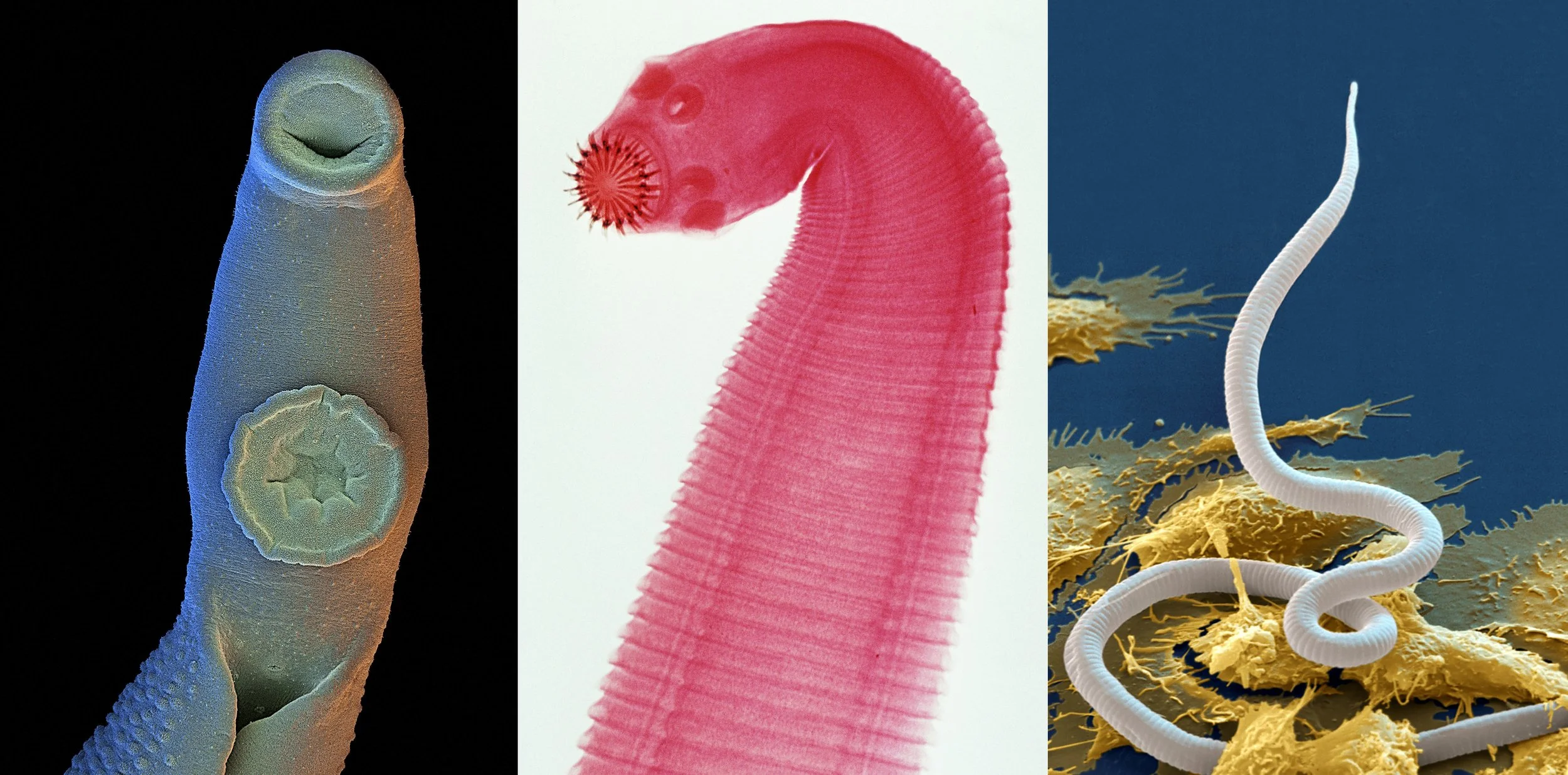 Close-up images of microscopic worms, each with different colors and structures, set against contrasting backgrounds.