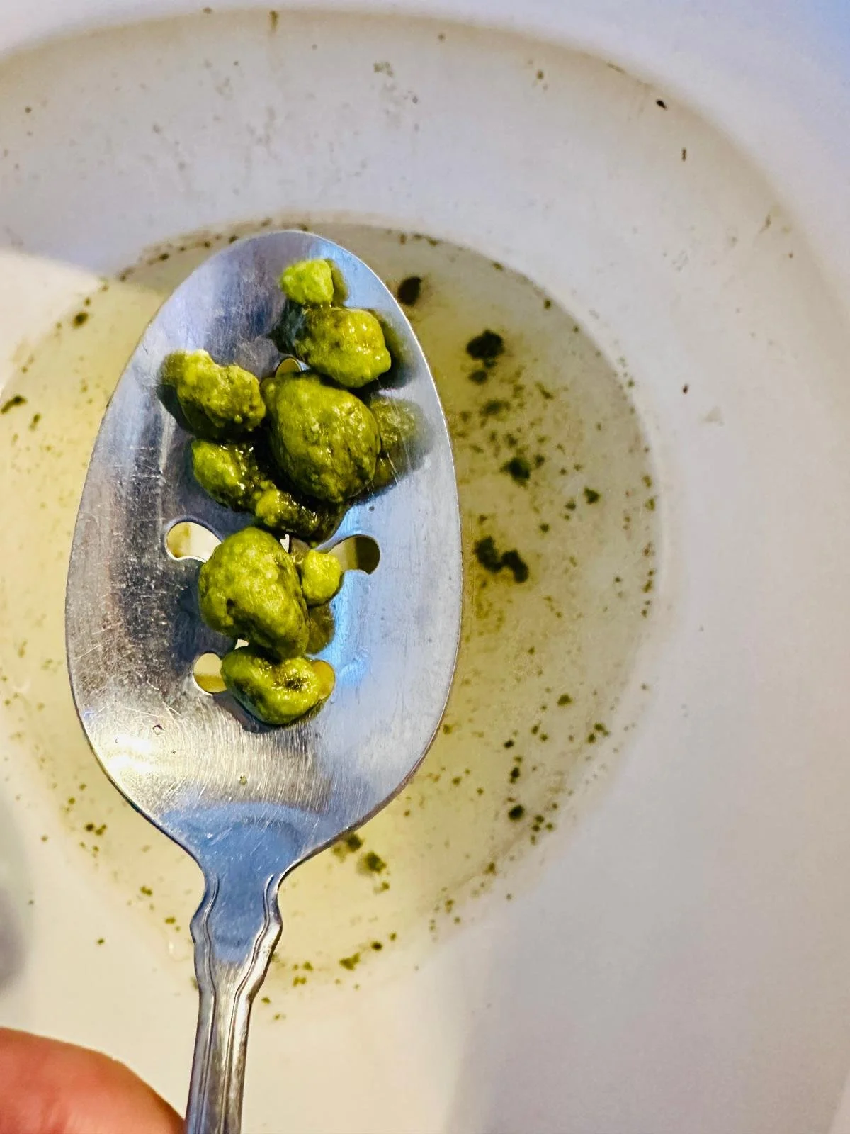 gallstones.jpeg