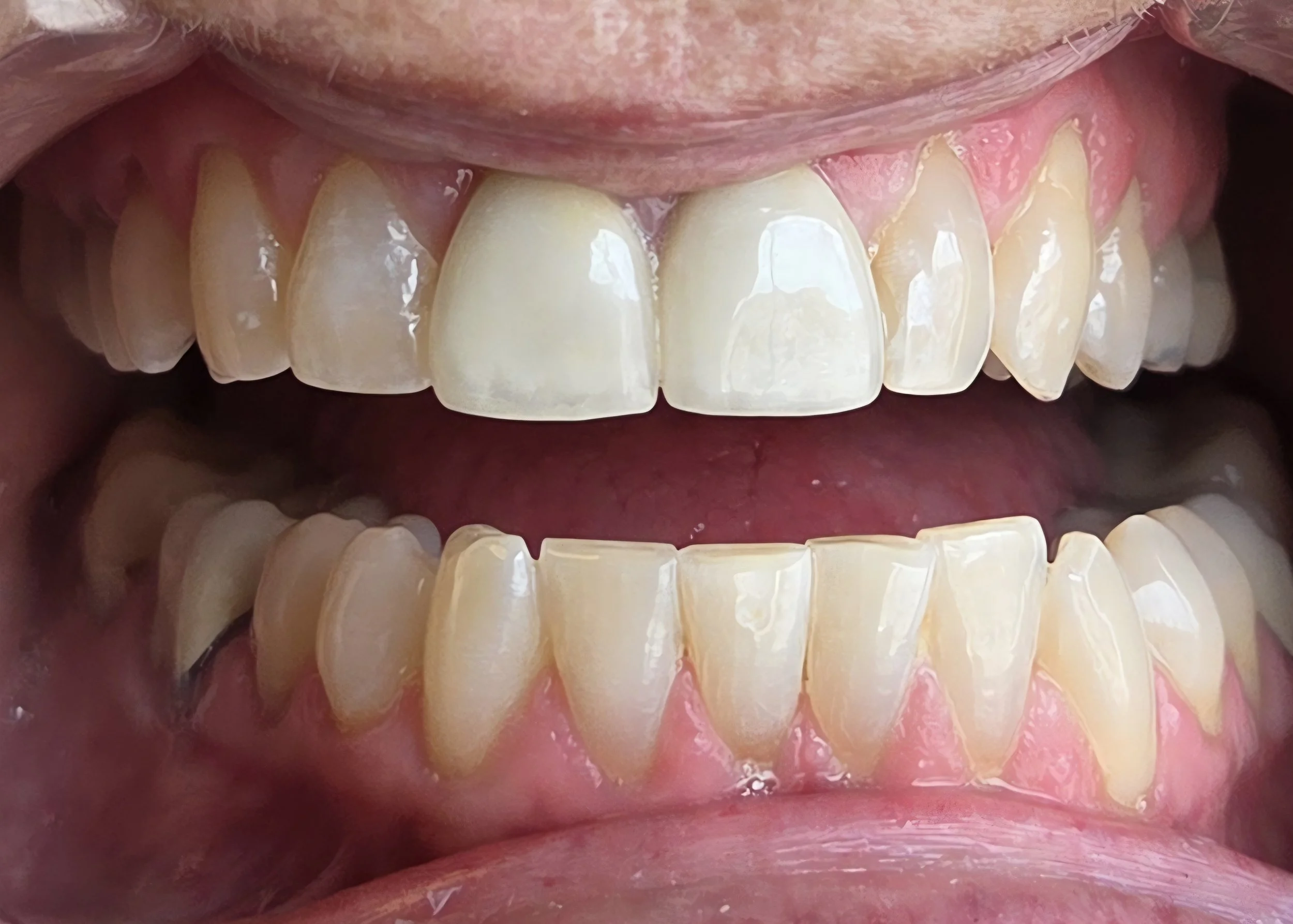 Close-up of an open mouth showing upper and lower teeth, gums, and tongue.