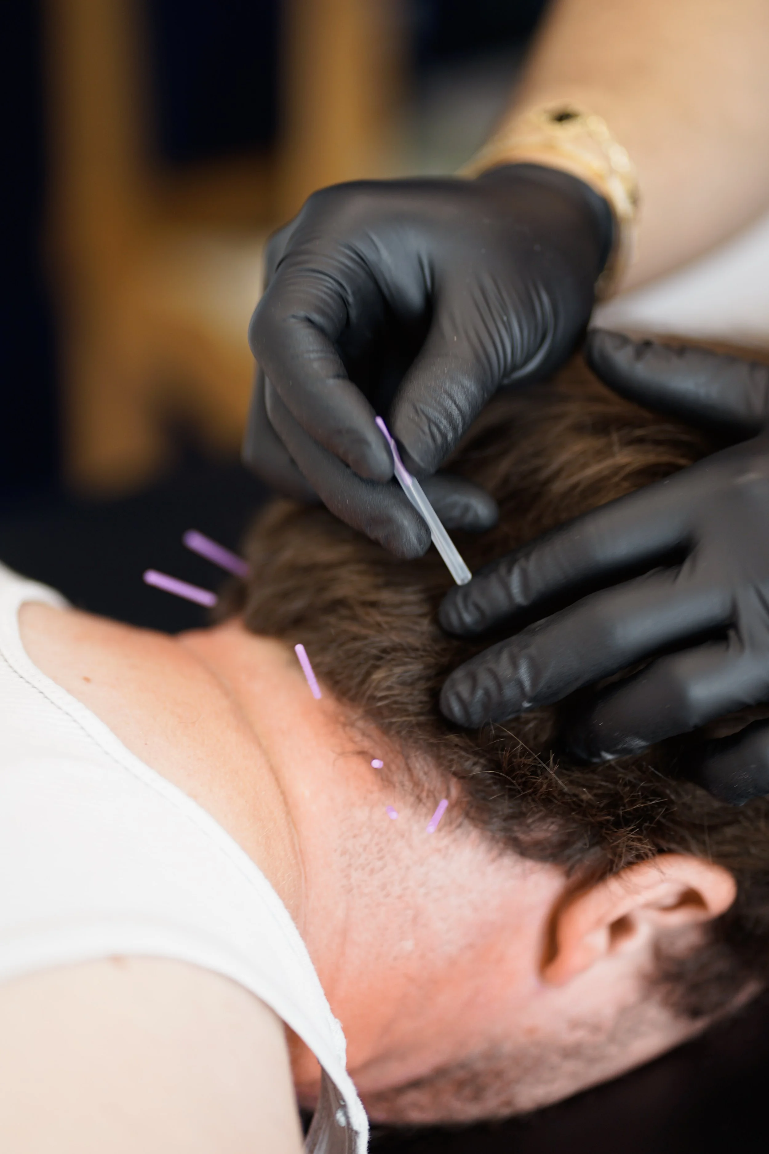 Follow-up Treatment